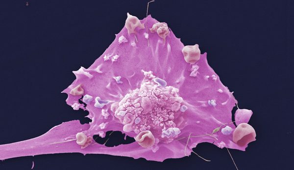 cell-breast-cancer.jpg