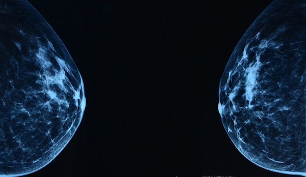breast_hero.jpeg