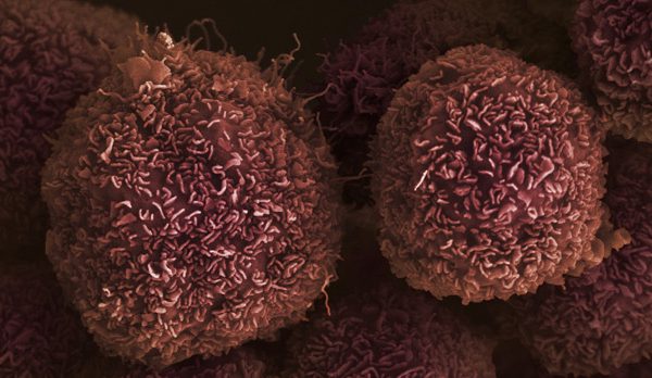 cell-pancreatic-cancer.jpg